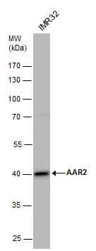 C20orf4 antibody detects C20orf4 protein by western blot analysis. Whole cell extracts (30 ug) was separated by 10% SDS-PAGE, and the membrane was blotted with C20orf4 antibody (NBP3-48558) diluted by 1:500. 