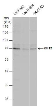KIF12 antibody detects KIF12 protein by Western blot analysis. Various whole cell extracts (30 ug) were separated by 10% SDS-PAGE, and the membrane was blotted with KIF12 antibody (NBP3-48561) diluted by 1:1000. 