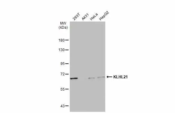 Various whole cell extracts (30 ?g) were separated by 7.5% SDS-PAGE, and the membrane was blotted with Kelch-Like Family Member 21 antibody [C1C3] (NBP3-48562) diluted at 1:1000. The HRP-conjugated anti-rabbit IgG antibody was used to detect the primary antibody. 