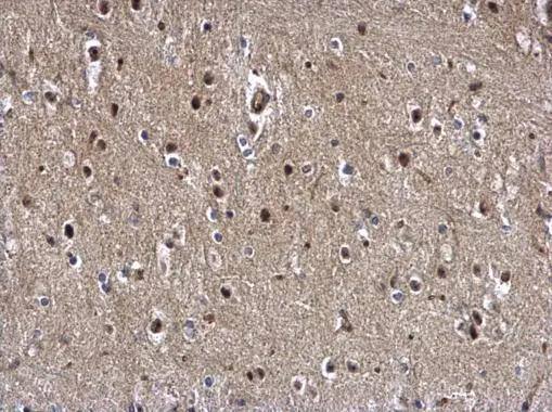 ZBTB5 antibody detects ZBTB5 protein at nucleus and cytosol on mouse prostate by immunohistochemical analysis. Sample: Paraffin-embedded mouse prostate. ZBTB5 antibody (NBP3-48564) dilution: 1:1000.Antigen Retrieval: (EDTA based, pH 8.0) buffer, 15min 