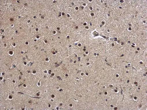 ZBTB5 antibody detects ZBTB5 protein at nucleus on rat fore brain by immunohistochemical analysis. Sample: Paraffin-embedded rat fore brain. ZBTB5 antibody (NBP3-48564) dilution: 1:1000.Antigen Retrieval: (EDTA based, pH 8.0) buffer, 15min 