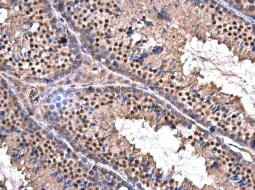 ZBTB5 antibody detects ZBTB5 protein at nucleus in mouse testis by immunohistochemical analysis. Sample: Paraffin-embedded mouse testis. ZBTB5 antibody (NBP3-48564) diluted at 1:500.Antigen Retrieval: Citrate buffer, pH 6.0, 15 min 