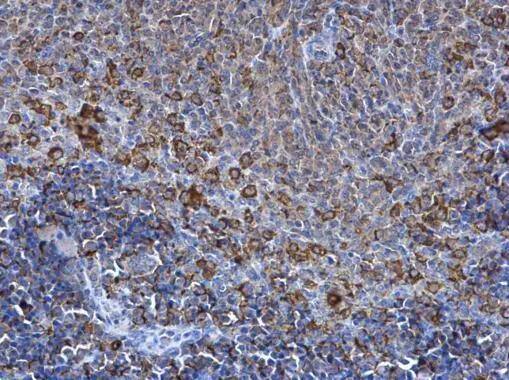 SPATA13 antibody detects SPATA13 protein at cytosol on mouse spleen by immunohistochemical analysis. Sample: Paraffin-embedded mouse spleen. SPATA13 antibody (NBP3-48565) dilution: 1:500. Antigen Retrieval: (EDTA based, pH 8.0) buffer, 15min 