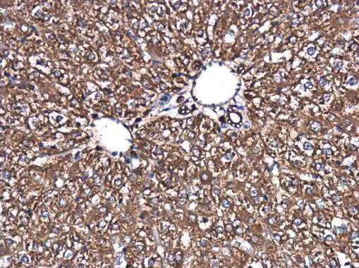 SPATA13 antibody detects SPATA13 protein at cytoplasm in rat liver by immunohistochemical analysis. Sample: Paraffin-embedded rat liver. SPATA13 antibody (NBP3-48565) diluted at 1:500. ^[^GTX]br>Antigen Retrieval: Citrate buffer, pH 6.0, 15 min 