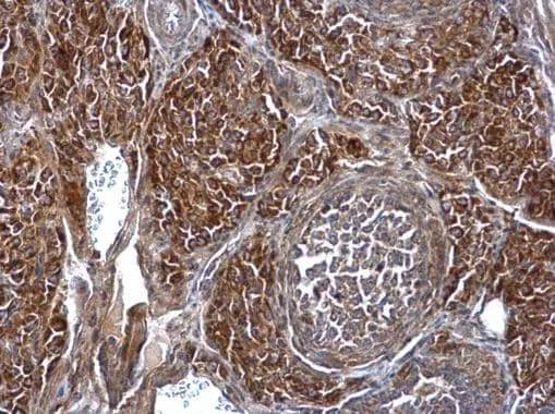 Immunohistochemistry SMPD4 Antibody