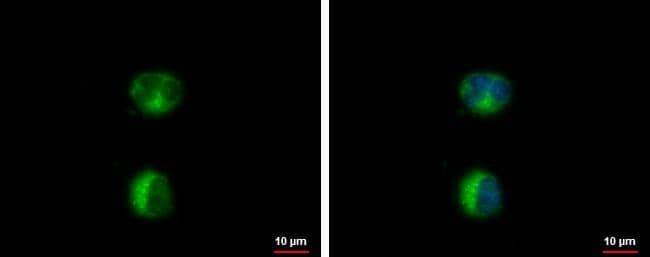 HEATR2 antibody detects HEATR2 protein at cytoplasm by immunofluorescent analysis.Sample: Raji cells were fixed in ice-cold MeOH for 5 min.Green: HEATR2 protein stained by HEATR2 antibody (NBP3-48568) diluted at 1:500.Blue: Hoechst 33342 staining. 