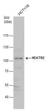 HEATR2 antibody detects HEATR2 protein by western blot analysis. Various whole cell extracts (30 ug) were separated by 7.5% SDS-PAGE, and the membrane was blotted with HEATR2 antibody (NBP3-48568) diluted by 1:1000. 