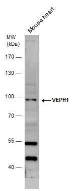 VEPH1 antibody detects VEPH1 protein by western blot analysis. Mouse tissue extracts (50 ug) was separated by 7.5 % SDS-PAGE, and the membrane was blotted with VEPH1 antibody (NBP3-48569) diluted by 1:1000. 
