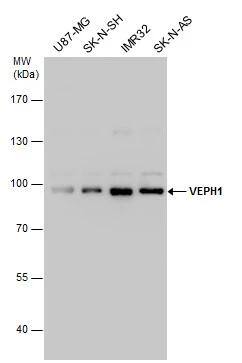 VEPH1 antibody detects VEPH1 protein by western blot analysis. Various whole cell extracts (30 ug) were separated by 7.5% SDS-PAGE, and the membrane was blotted with VEPH1 antibody (NBP3-48569) diluted by 1:1000. 