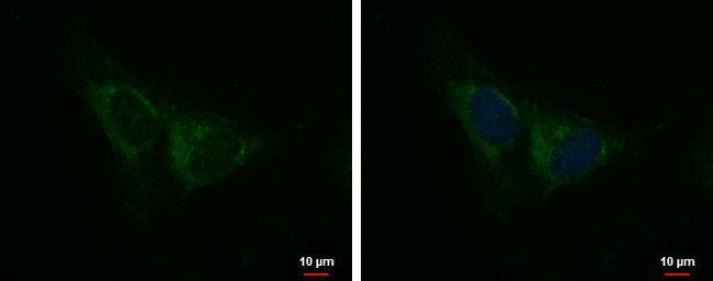 Immunocytochemistry/ Immunofluorescence IQCA1 Antibody