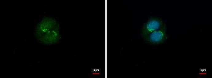 KIAA1217 antibody detects KIAA1217 protein at endoplasmic reticulum by immunofluorescent analysis.Sample: MCF-7 cells were fixed in ice-cold MeOH for 5 min.Green: KIAA1217 protein stained by KIAA1217 antibody (NBP3-48571) diluted at 1:500.Blue: Hoechst 33342 staining. 