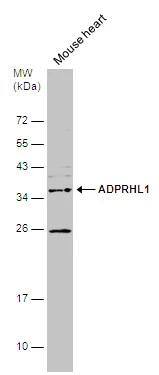 Western Blot ADPRHL1 Antibody