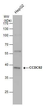 CCDC92 antibody detects CCDC92 protein by western blot analysis. Whole cell extracts (30 ug) was separated by 10% SDS-PAGE, and the membrane was blotted with CCDC92 antibody (NBP3-48576) at a dilution of 1:500. 