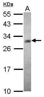 Sample (30 ug of whole cell lysate)  A: HeLa treat tunicamycin (4ug/ml)  12% SDS PAGE  NBP3-48577 diluted at 1:500 The HRP-conjugated anti-rabbit IgG antibody was used to detect the primary antibody. 
