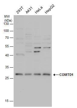 COMTD1 antibody detects COMTD1 protein by western blot analysis. Various whole cell extracts (30 ug) were separated by 12% SDS-PAGE, and the membrane was blotted with COMTD1 antibody (NBP3-48578) diluted by 1:1000. 