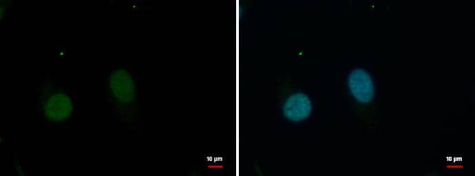 Immunocytochemistry/ Immunofluorescence GPBP1L1 Antibody