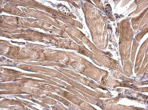 LRRFIP2 antibody detects LRRFIP2 protein at cytosol on mouse muscle by immunohistochemical analysis. Sample: Paraffin-embedded mouse muscle. LRRFIP2 antibody (NBP3-48580) dilution: 1:500. Antigen Retrieval: (EDTA based, pH 8.0) buffer, 15min 