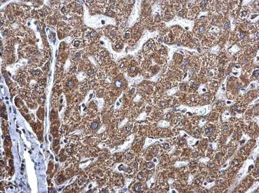Immunohistochemistry MAGEE2 Antibody