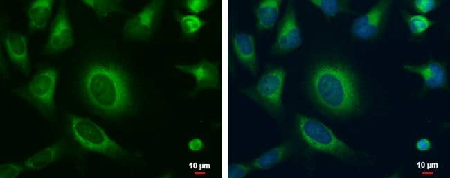 MOSC1 antibody detects MOSC1 protein at cytoplasm by immunofluorescent analysis. Sample: HeLa cells were fixed in 2% paraformaldehyde/PBS at 37C for 30 min.Green: MOSC1 protein stained by MOSC1 antibody (NBP3-48582) diluted at 1:500.Blue: Hoechst 33342 staining. 