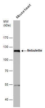 NEBL antibody detects NEBL protein by western blot analysis. Mouse tissue extracts (50 ug) was separated by 7.5 % SDS-PAGE, and the membrane was blotted with NEBL antibody (NBP3-48583) diluted by 1:3000. 