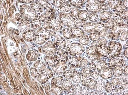 NKAP antibody detects NKAP protein at nucleus on mouse duodenum by immunohistochemical analysis. Sample: Paraffin-embedded mouse duodenum. NKAP antibody (NBP3-48584) dilution: 1:500. Antigen Retrieval: (EDTA based, pH 8.0) buffer, 15min 