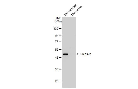 <b>Orthogonal Strategies Validation. </b>Various tissue extracts (50 ug) were separated by 10% SDS-PAGE, and the membrane was blotted with NKAP antibody (NBP3-48584) diluted at 1:1000. The HRP-conjugated anti-rabbit IgG antibody was used to detect the primary antibody. 