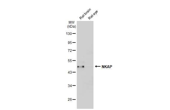 <b>Orthogonal Strategies Validation. </b>Various tissue extracts (50 ug) were separated by 10% SDS-PAGE, and the membrane was blotted with NKAP antibody (NBP3-48584) diluted at 1:1000. The HRP-conjugated anti-rabbit IgG antibody was used to detect the primary antibody. 