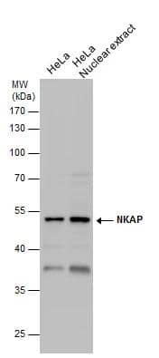 <b>Orthogonal Strategies Validation. </b>NKAP antibody detects NKAP protein by western blot analysis. HeLa whole cell extracts and nuclear extracts (30 ug) were separated by 10% SDS-PAGE, and the membrane was blotted with NKAP antibody (NBP3-48584) at a dilution of 1:1000. 