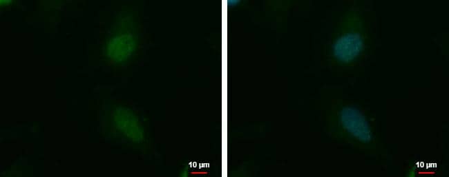 NKAP antibody detects NKAP protein at nucleus by immunofluorescent analysis. Sample: HeLa cells were fixed in 4% paraformaldehyde/PBS for 15 min.Green: NKAP protein stained by NKAP antibody (NBP3-48585) diluted at 1:500.Blue: Hoechst 33342 staining. 