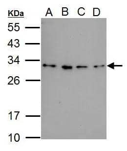 Sample (30 ug of whole cell lysate)  A: 293T  B: A431  C: HeLa  D: HepG2  12% SDS PAGE  NBP3-48586 diluted at 1:1000  
