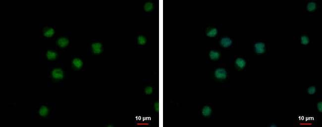 Immunocytochemistry/ Immunofluorescence KOX2 Antibody