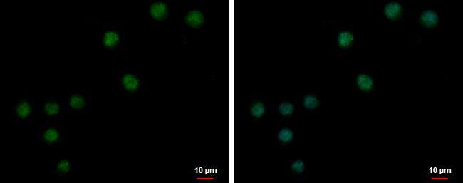 Immunocytochemistry/ Immunofluorescence ZNF257 Antibody