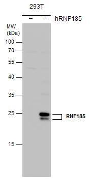 RNF185 antibody detects RNF185 protein by western blot analysis. Non-transfected (-) and RNF185-transfected (+, ) 293T whole cell extracts (30 ug) were separated by 12% SDS-PAGE, and the membrane was blotted with RNF185 antibody (NBP3-48591) at a dilution of 1:5000. 