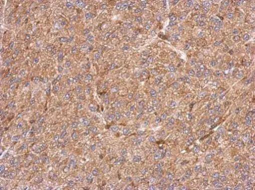 Immunohistochemical analysis of paraffin-embedded U87 xenograft, using CCDC105(NBP3-48592) antibody at 1:500 dilution.Antigen Retrieval: (EDTA based, pH 8.0) buffer, 15min 