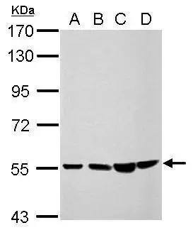 Sample (30 ug of whole cell lysate)  A: NT2D1  B: PC-3  C: U87-MG  D: SK-N-SH  7.5% SDS PAGE  NBP3-48592 diluted at 1:1000  