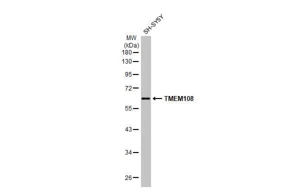 Whole cell extract (30 ug) was separated by 10% SDS-PAGE, and the membrane was blotted with TMEM108 antibody (NBP3-48593) diluted at 1:500. The HRP-conjugated anti-rabbit IgG antibody was used to detect the primary antibody. 