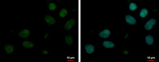 Immunocytochemistry/ Immunofluorescence MYT1L Antibody