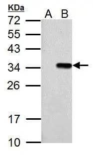 T7 Epitope Tag antibody detects T7 Epitope Tag protein by western blot analysis.A. 30 ug 293T whole cell lysate/extractB. 30 ug whole cell lysate/extract of T7-tagged protein expressing 293T cells12% SDS-PAGET7 Epitope Tag antibody (NBP3-48602) dilution: 1:10000 The HRP-conjugated anti-rabbit IgG antibody was used to detect the primary antibody. 