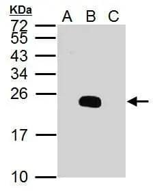 prM (Dengue virus 2) antibody detects prM (Dengue virus 2) protein by western blot analysis.A.30 ug BHK-21 whole cell lysate/extractB.30 ug whole cell lysate/extract of Dengue virus 2 infected BHK-21 cellsC.30 ug whole cell lysate/extract of JEV virus infected BHK-21 cells15% SDS-PAGEprM (Dengue virus 2) antibody (NBP3-48604) dilution: 1:5000 The HRP-conjugated anti-rabbit IgG antibody was used to detect the primary antibody. 
