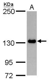 PPP1R3A antibody detects PPP1R3A protein by Western blot analysis.A. 30 ug Jurkat whole cell lysate/extract5 % SDS-PAGEPPP1R3A antibody (NBP3-48605) dilution: 1:1000 