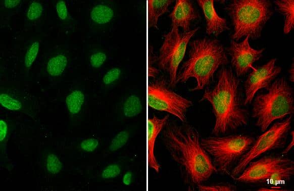 Immunocytochemistry/ Immunofluorescence CDYL2 Antibody