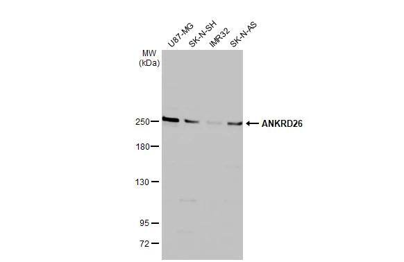 Western Blot ANKRD26 Antibody