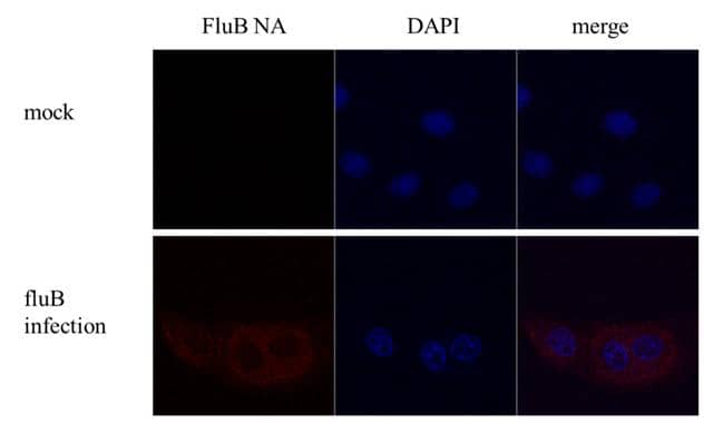 Influenza B Virus Neuraminidase (NA) antibody detects Influenza B Virus Neuraminidase (NA) protein by immunofluorescent analysis.Sample: MDCK cells infected with Influenza B virus (Taiwan B70555).Green: Influenza B Virus Neuraminidase (NA) protein stained by Influenza B Virus Neuraminidase (NA) antibody (NBP3-48608) diluted at 1:500.Blue: Hoechst 33342 staining. 