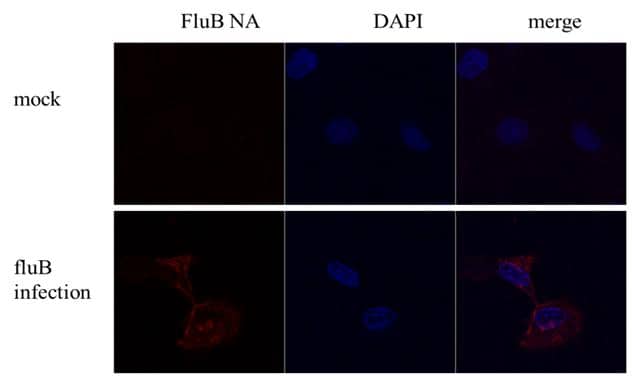 Influenza B Virus Neuraminidase (NA) antibody detects Influenza B Virus Neuraminidase (NA) protein by immunofluorescent analysis.Sample: MDCK cells infected with Influenza B virus (Taiwan B70555).Green: Influenza B Virus Neuraminidase (NA) protein stained by Influenza B Virus Neuraminidase (NA) antibody (NBP3-48609) diluted at 1:500.Blue: Hoechst 33342 staining. 