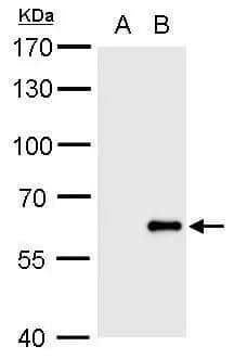Western Blot Influenza B Antibody