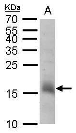 CHAC2 antibody detects CHAC2 protein by Western blot analysis.A. 30 ug human ESC whole cell lysate/extract15 % SDS-PAGECHAC2 antibody (NBP3-48611) dilution: 1:1000 