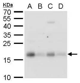 CHAC2 antibody detects CHAC2 protein by Western blot analysis.A. 30 ug 293T whole cell lysate/extractB. 30 ug A431 whole cell lysate/extractC. 30 ug HeLa whole cell lysate/extractD. 30 ug HepG2 whole cell lysate/extract15 % SDS-PAGECHAC2 antibody (NBP3-48611) dilution: 1:500 