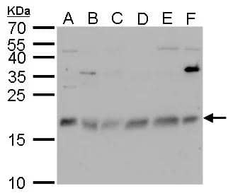CHAC2 antibody detects CHAC2 protein by Western blot analysis.A. 30 ug Neuro2A whole cell lysate/extractB. 30 ug C8D30 whole cell lysate/extractC. 30 ug NIH-3T3 whole cell lysate/extractD. 30 ug BCL-1 whole cell lysate/extractE. 30 ug Raw264.7 whole cell lysate/extractF. 30 ug C2C12 whole cell lysate/extract15 % SDS-PAGECHAC2 antibody (NBP3-48611) dilution: 1:500 