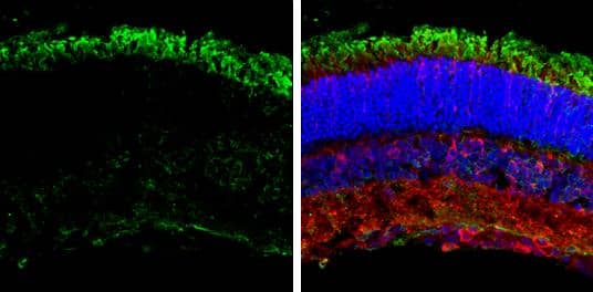 GNAT2 antibody [N3C3] detects GNAT2 protein expression by immunohistochemical analysis.Sample: Frozen sectioned adult mouse retina. Green: GNAT2 protein stained by GNAT2 antibody [N3C3] (NBP3-48504) diluted at 1:250.Red: beta Tubulin 3/ TUJ1, stained by beta Tubulin 3/ TUJ1 antibody [GT11710] diluted at 1:250.Blue: Fluoroshield with DAPI . 