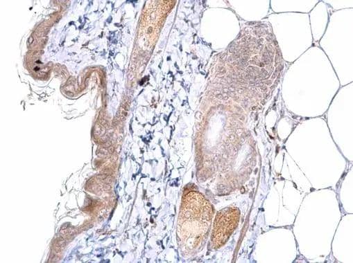 Immunohistochemistry ATOH7 Antibody
